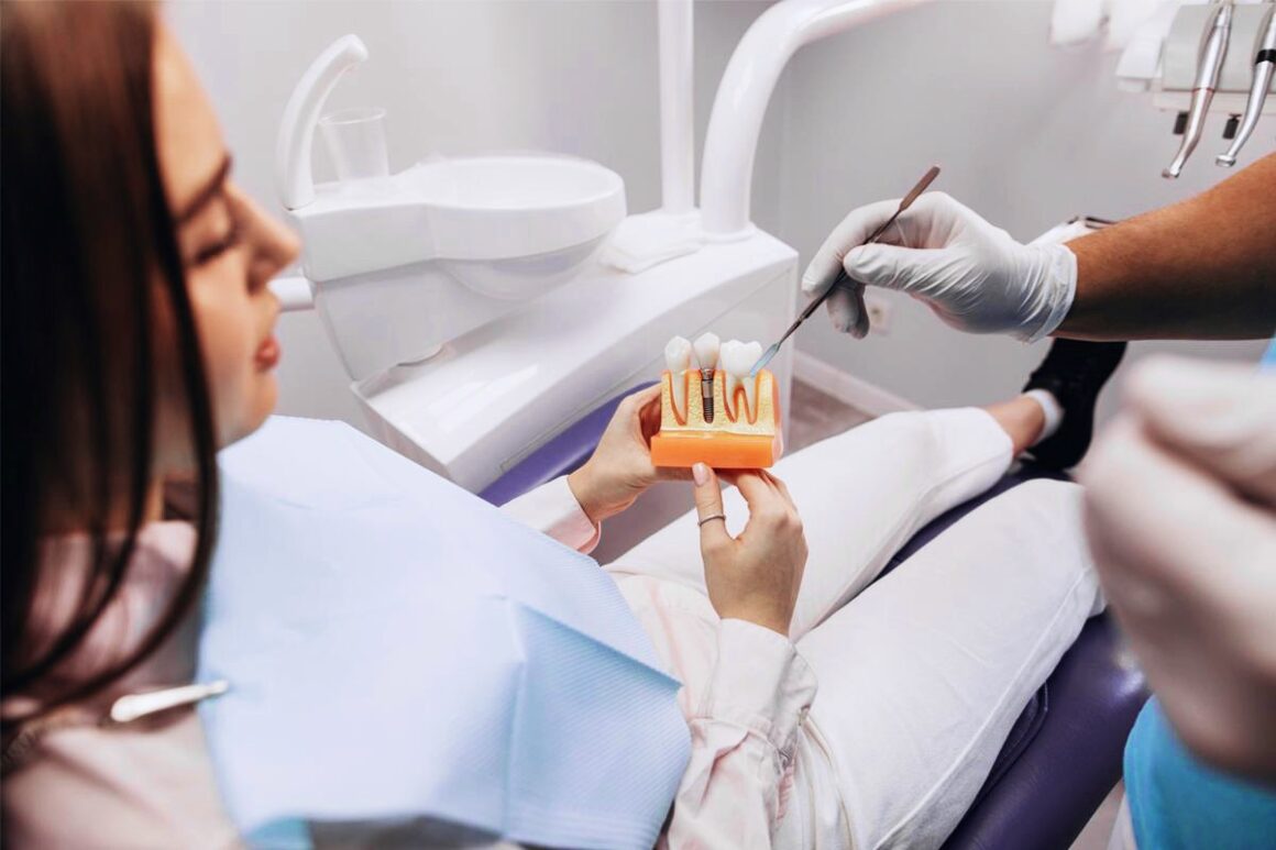 Implantes dentales