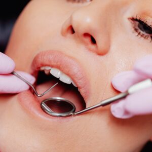 Rehabilitación Oral