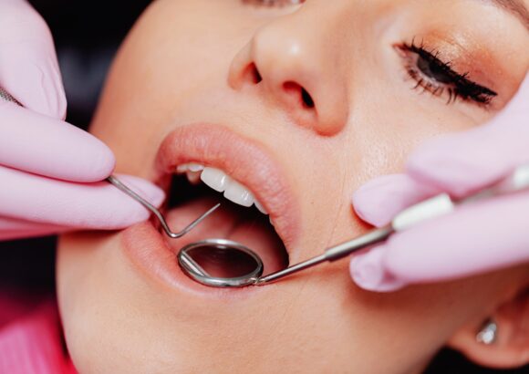 Rehabilitación Oral
